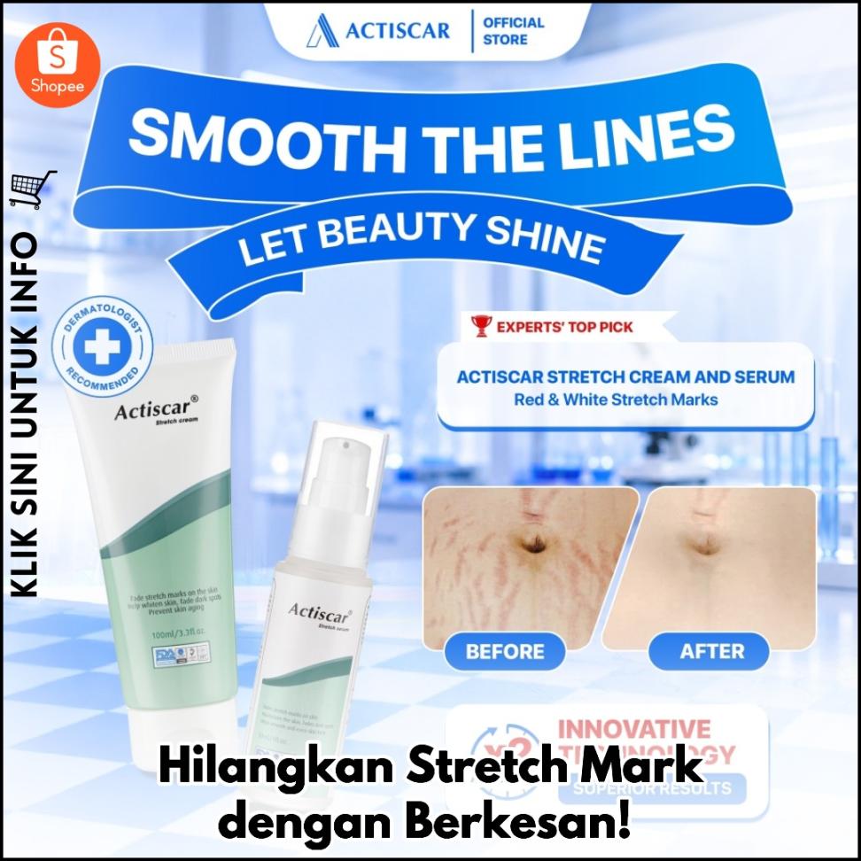 Hilangkan Stretch Mark dengan Berkesan!