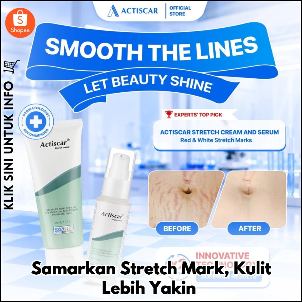 Samarkan Stretch Mark, Kulit Lebih Yakin