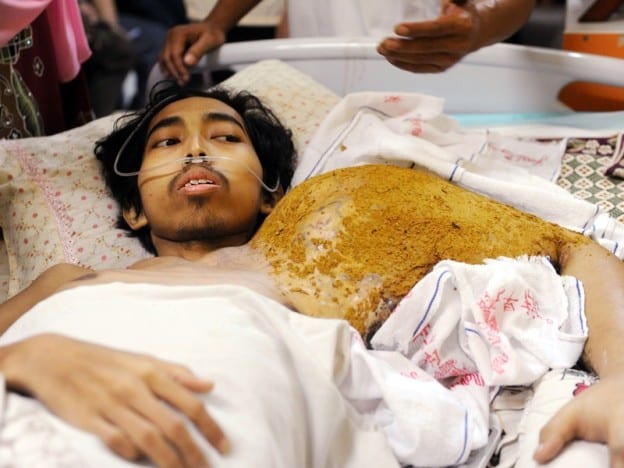 Abu Ammar Derita Kanser Tulang Meninggal Dunia 5