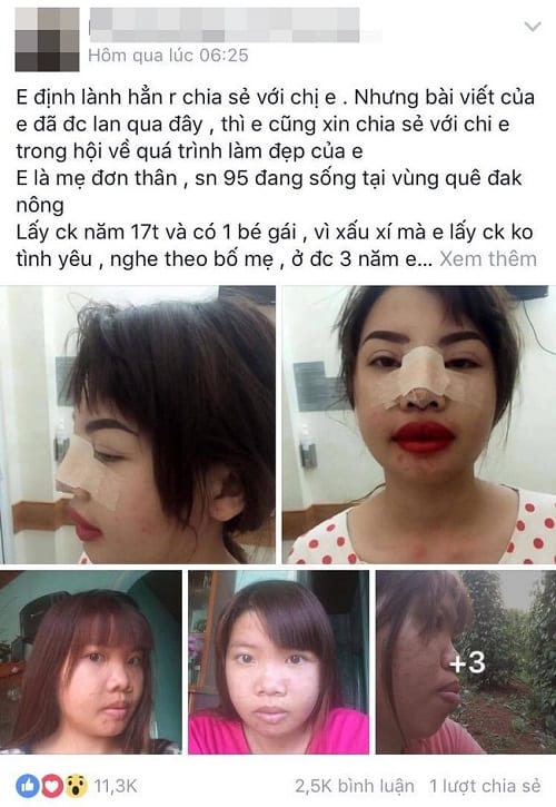 Berwajah Hodoh Dan Sering Dihina,Wanita Ini Tekad Mahu Jadi Cantik