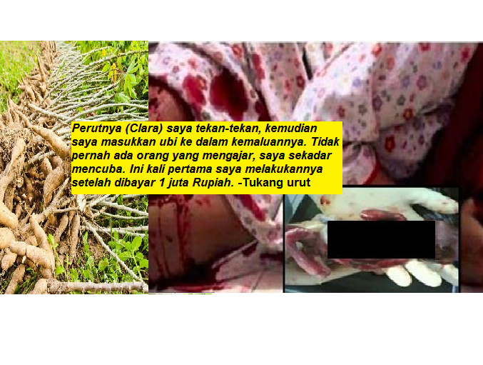 Gadis Gugurkan Kandungan Menggunakan Batang Ubi, Buang 