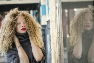 Dulu Digelar Hantu, Kini Gadis Albino Menjadi Model Cantik