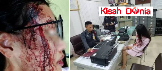 Sudahlah Buntingkan Anak Orang,Di Belasahnya Pula Perempuan Tu Sampai Pecah Muka