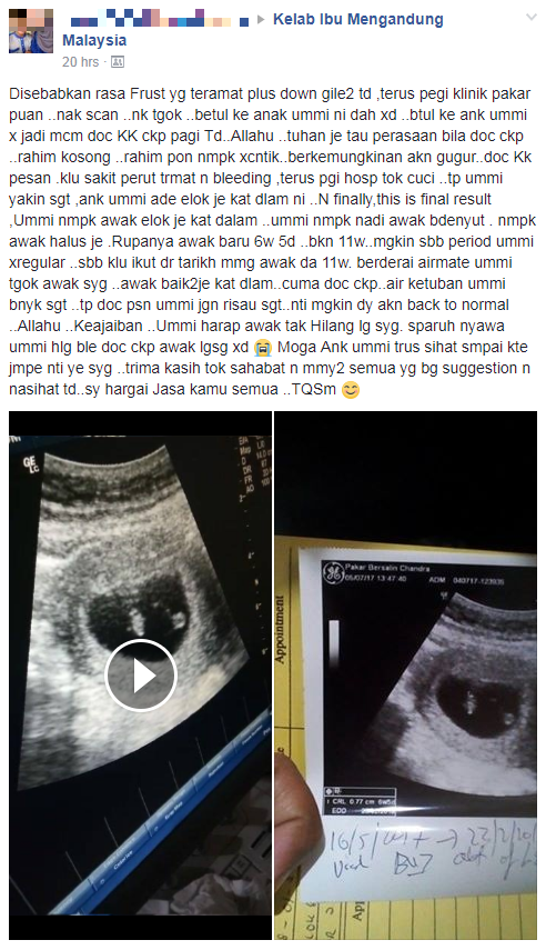 Doktor Cakap Rahim Dah Kosong, Mungkin Akan Gugur. Rupanya…