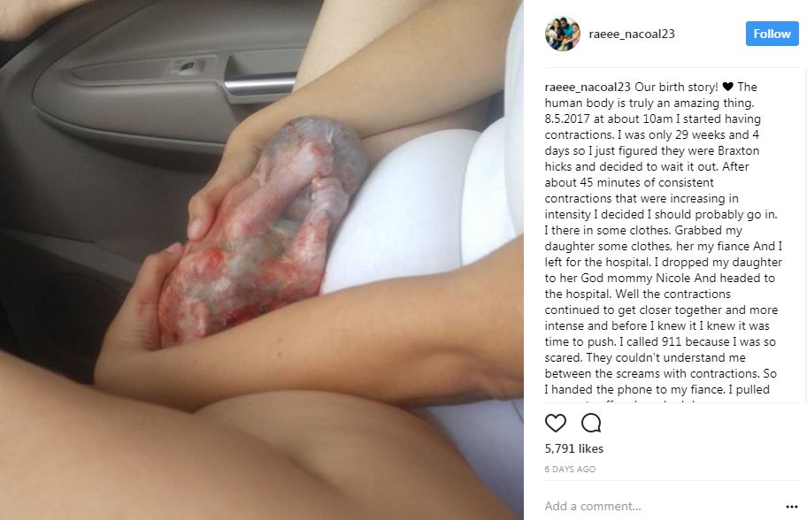 Orang Ramai Terkejut Lihat Keadaan Bayi Pramatang Ini Ketika Dilahirkan Di Dalam Kereta!