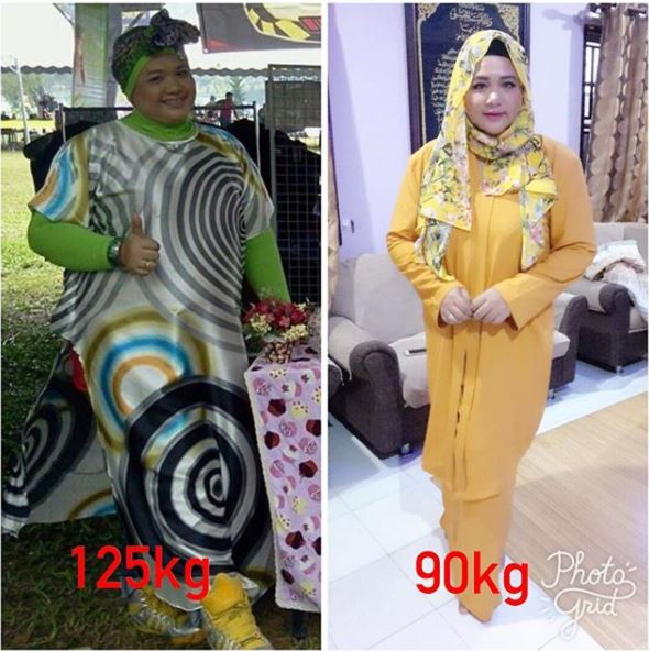 Berjaya Turunkan 56 Kg, Ini 20 Foto Terkini Enot Yang Buat Netizen Tidak Percaya!!