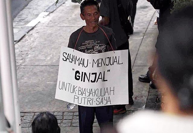 Lelaki Ini Jual Ginjal Untuk Dapatkan Duit dan Beli Smartphone,Ini Yang Berlaku Kepadanya Tiga Hari Selepas Itu