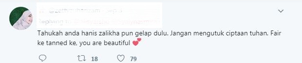 “Kalau Muka Cerah Sikit Sama Dengan Hanis Zalikha..”, Adik Kandung Hanis Diminta Putihkan Kulit!