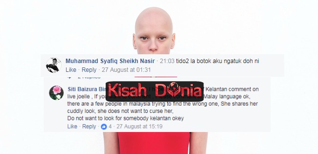 “Kepala Awak Seperti Kemaluan”-Netizen Kutuk Pesakit Kanser Yang Botak Live Di Facebook