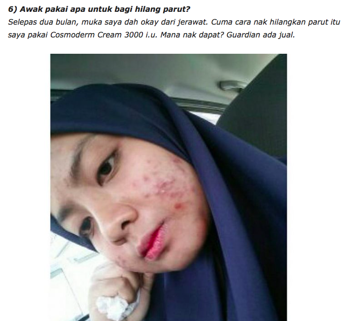 Bermodalkan RM300, Akhirnya Wajah Gadis Ini Kembali Pulih & Cantik. Bagaimana?