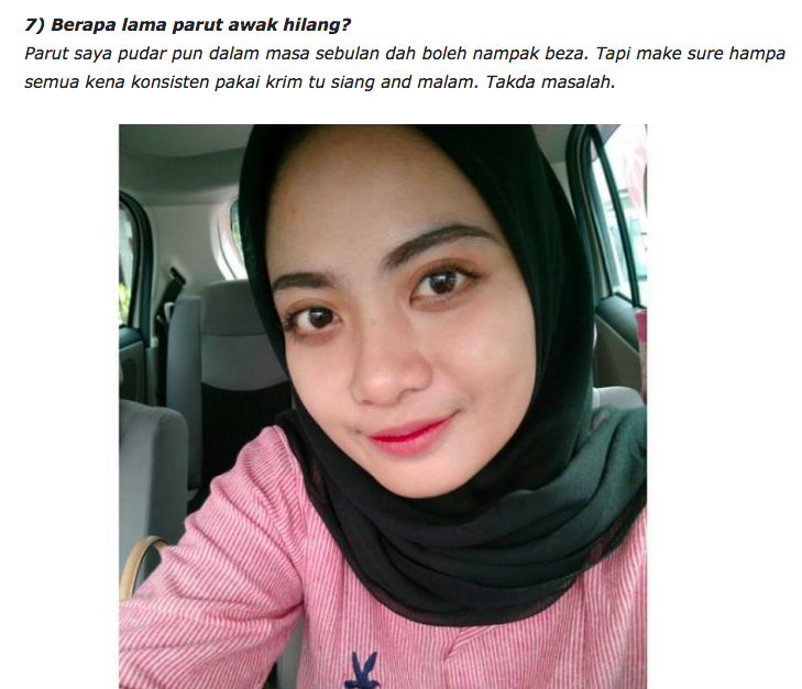 Bermodalkan RM300, Akhirnya Wajah Gadis Ini Kembali Pulih & Cantik. Bagaimana?