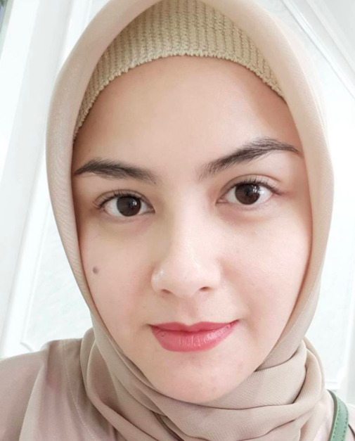 (Gambar) Cantik! Wajah Terkini ‘Bawang Putih’ Selepas Berhijab.. Makin Cun & Meletop!