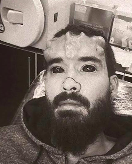 Potong Hidung, Tatoo Mata – Transformasi Henry Damon Tarik Perhatian Netizen. Seram Weh!