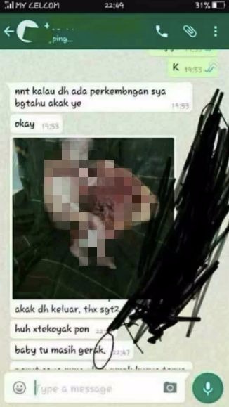 Lebih Hina Dari Binatang, Pil Gugur Bayi Dijual Di Wechat.. Kejam!