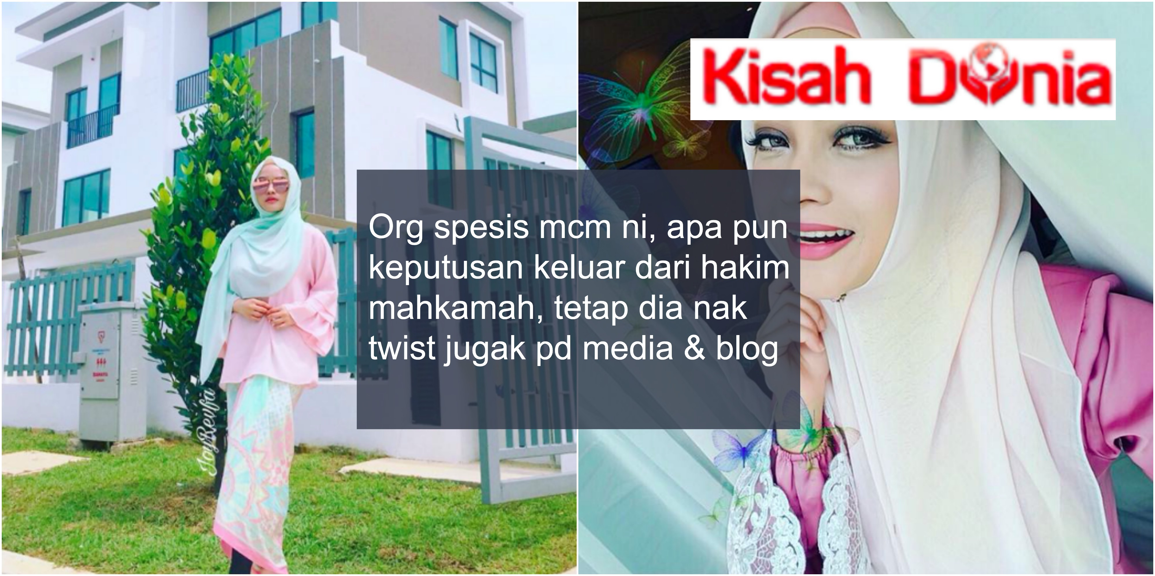 (Gambar) Cantik! Wajah Terkini ‘Bawang Putih’ Selepas Berhijab.. Makin Cun & Meletop!