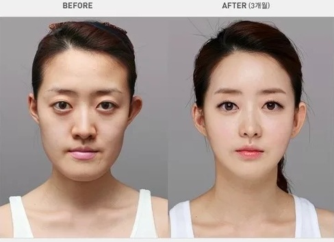 Siapa Cakap Semua Artis Korea Cantik Sebab Buat Pembedahan Plastik? Ini Dia Artis Korea Yang Cantik Secara Semulajadi Yang Disahkan Oleh Pakar