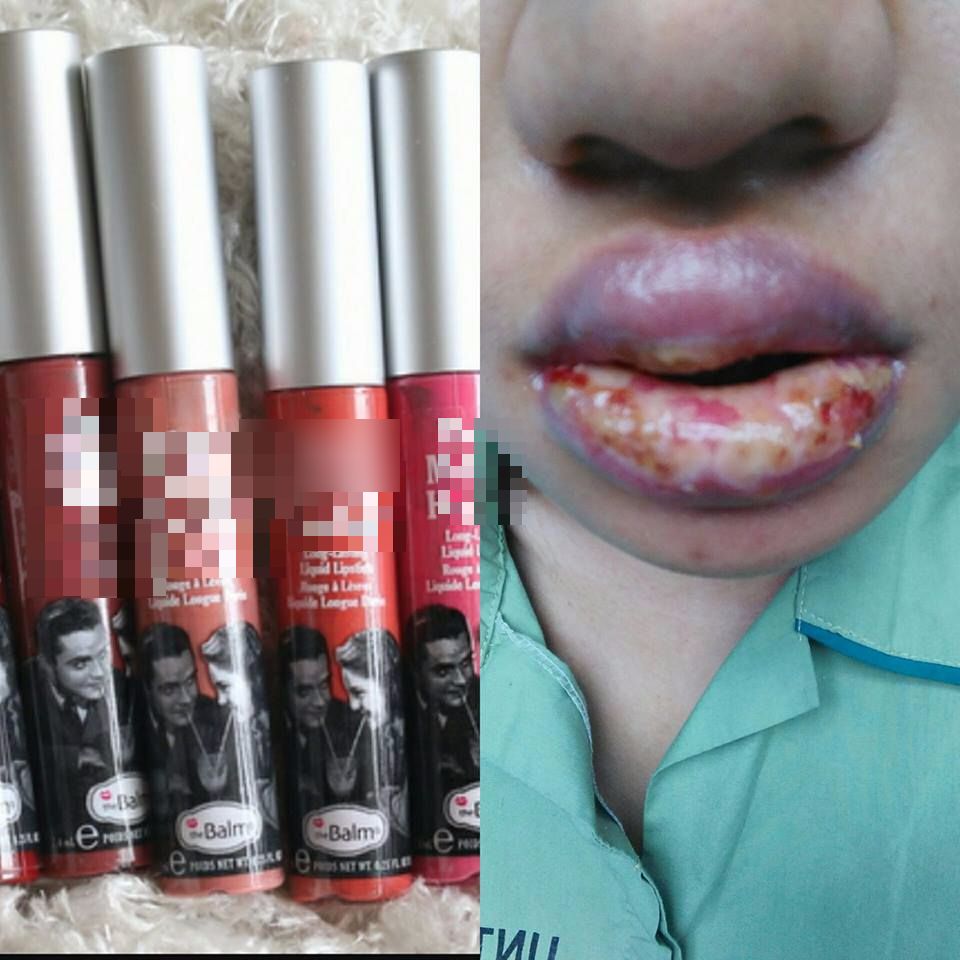 “Doktor Pakar Sarankan Buang Tonsil & Gusi Bengkak…” -Bahana Kosmetik Murah, Gadis Kongsi Pengalaman Ngeri Guna Lipstik Tiruan!