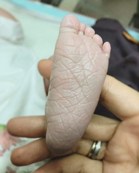 (FOTO) ‘Subhanallah, Tengok Kedut Jarinya’ -Sakti Kencana Fitri Bayi Kedua Fynn Jamal Yang Sangat Comel!
