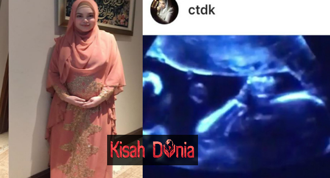 Datuk ‘Darah Manis’ Kahwini Gadis 17 Tahun, Akhirnya Jumpa ‘Cinta Sejati’..