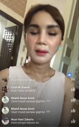 Aliff Syukri Soal Selidik Sajat Kes Viral Kerana Muka Bengkak,Ini Jawapan Dan Penjelasan Dari Sajat