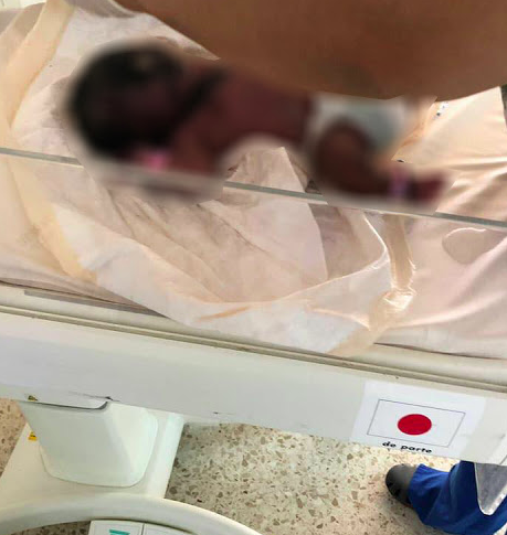 Ibu Masih Trauma – Bayi Baru Lahir Terbakar Hidup-Hidup, Netizen Lahir Rasa Simpati