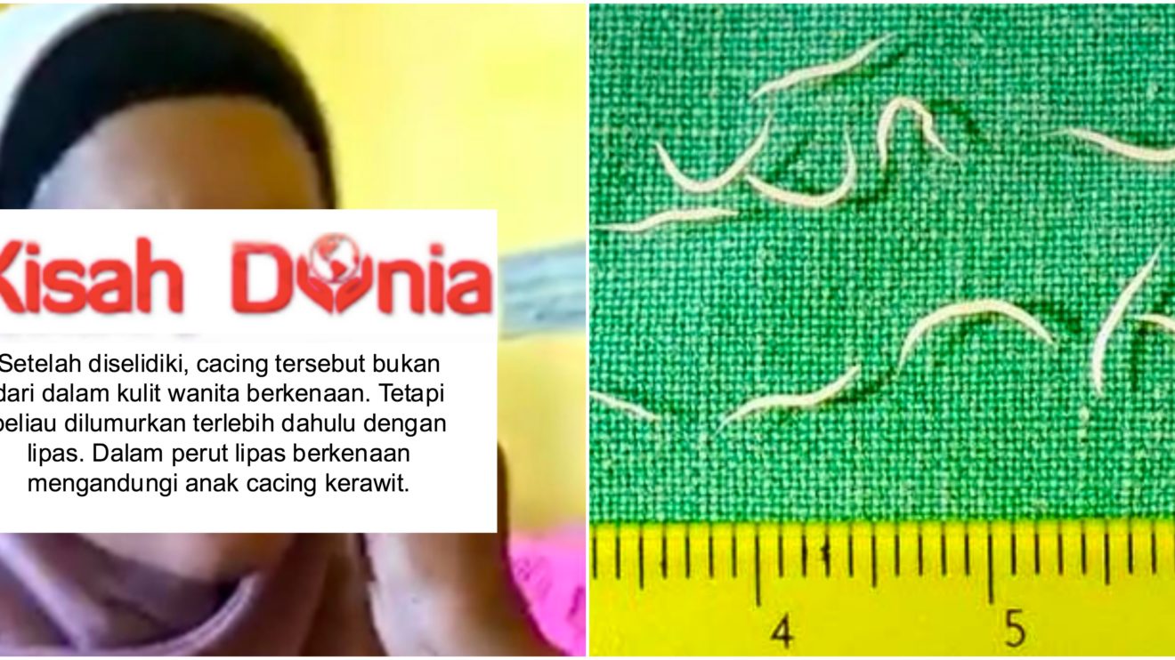 Tak Pernah Tercatat Dalam Kitab Perubatan Doktor Rungkai Rawatan Resdung Keluar Cacing Dari Muka Kisah Dunia