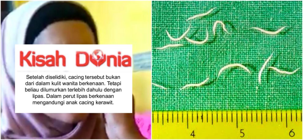 penjelasan kitab kejadian Tak Pernah Tercatat Dalam Kitab Perubatan Doktor 