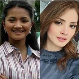 Perubahan Drastik Pada Wajah Artis Wanita Popular Ini Betul-betul Buat Para Peminat Mereka Terkesima