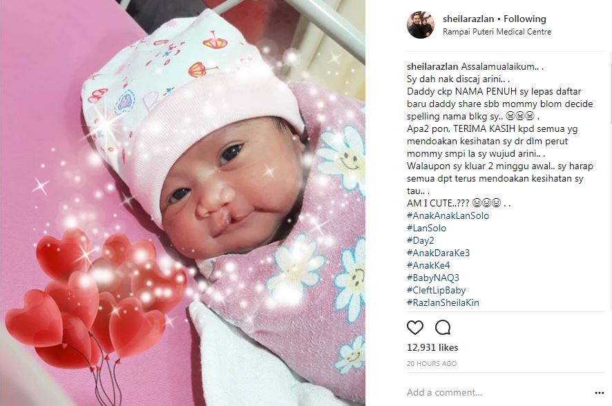 “Walau Sumbing Tapi Tetap Comel” – Peminat Doakan Bayi Keempat Lan Solo..