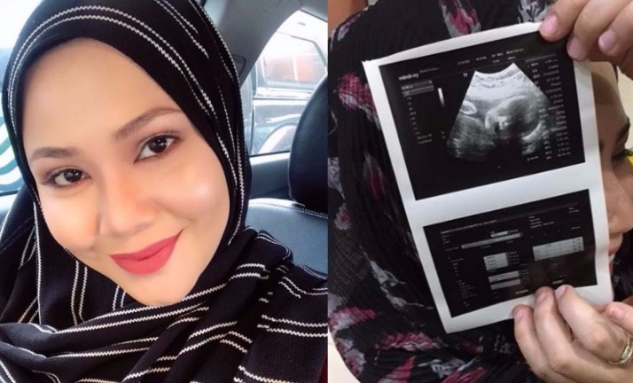 “Cantiknyer Mata Baby, Dah Macam Pakai Contact Lens Pula!”-Anak Kedua Feeya Iskandar Bermata Cantik,Netizen Terkejut Sebab Kagum