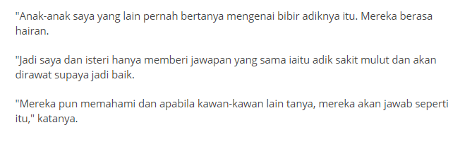 “Tunggu Berat 5 Kg” – Lan Solo Dan Isteri Setuju Lakukan Pembedahan Bibir Anak Keempatnya