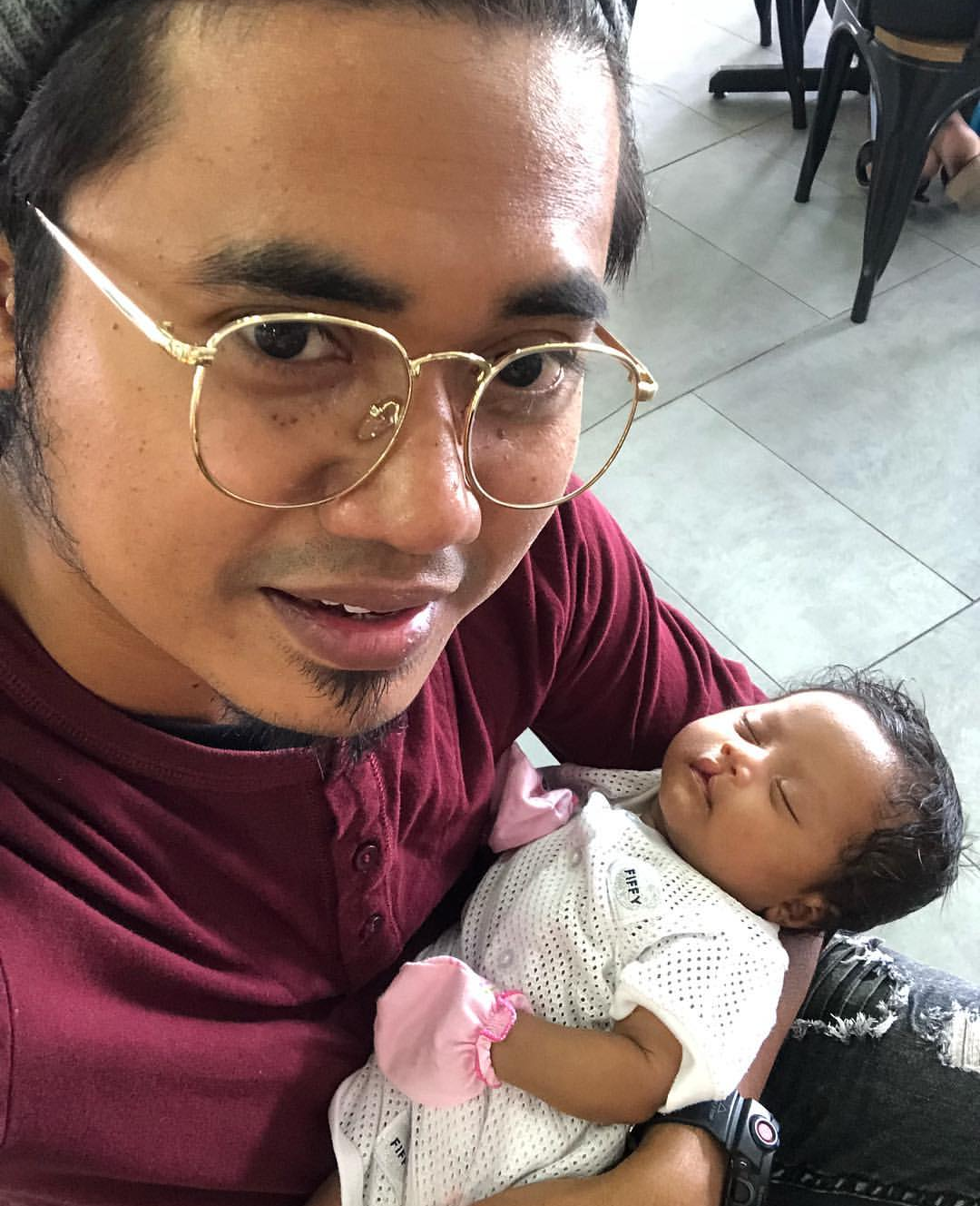"Minta Peminat Doakan Pembedahan Baby Xandra Berjalan Lancar..."-Lan Solo Dedah Anaknya Bakal Jalani Pembedahan Bibir Sumbing 7