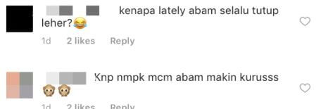 Nampak Susut & Sering Tutup Leher Dengan Mafla, Penampilan Terbaru Fendy Bakry Dipersoal Netizen