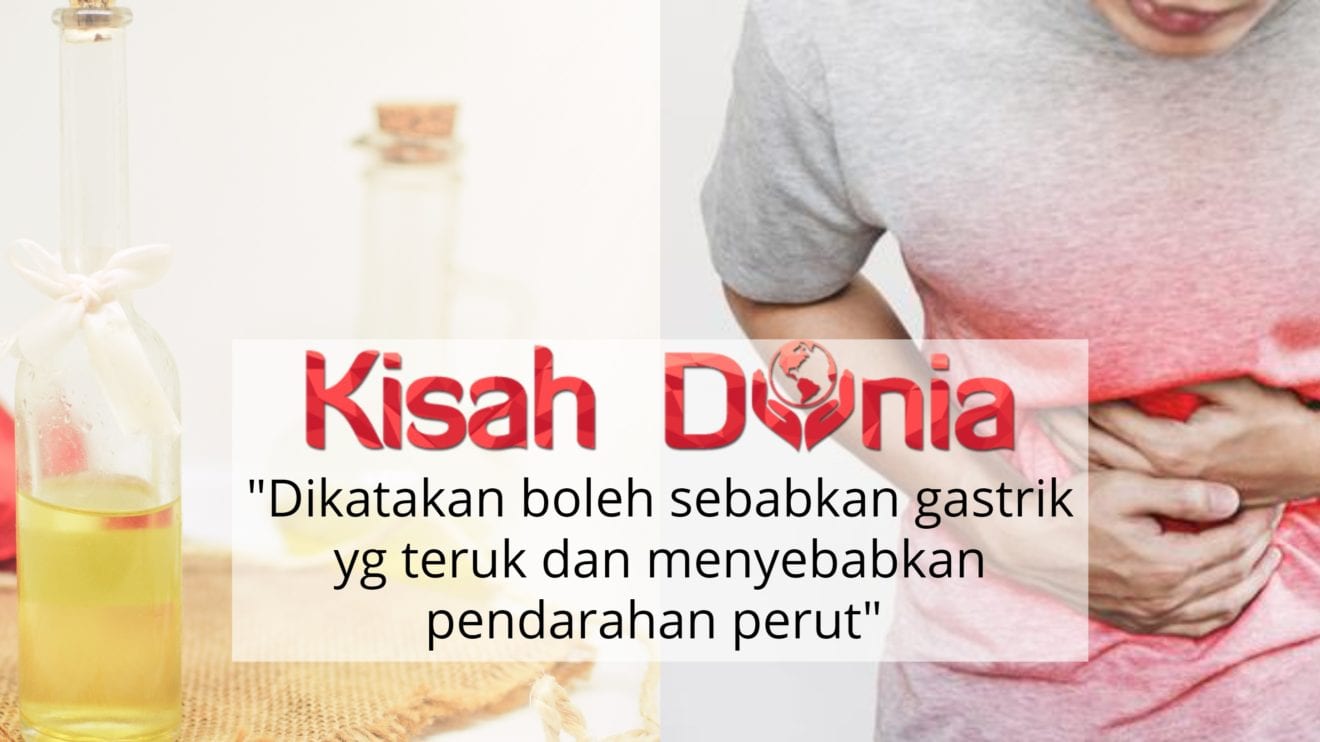 Cuka Sebabkan Gastrik Teruk Doktor Ini Dedah Cara Yang Betul Untuk Berawat Kisah Dunia