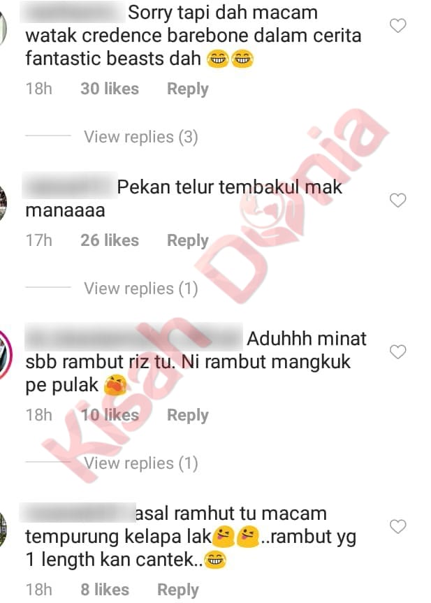 “Macam Psiko”- Tiada Lagi Imej Macho, Rambut 2019 Aedy Ashraf Jadi Bahan Jenaka