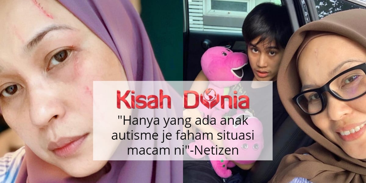 [VIDEO] Wajah Luk4 Akibat Dicakar, Netizen Sebak Lihat Ibu Adam Autisme... 2