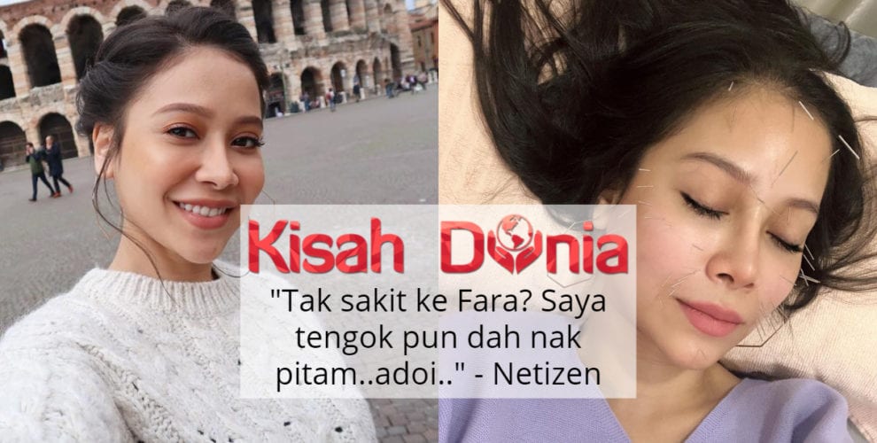 Kongsi Foto Rawatan Akupuntur, Farah Nabilah Buat Ramai 