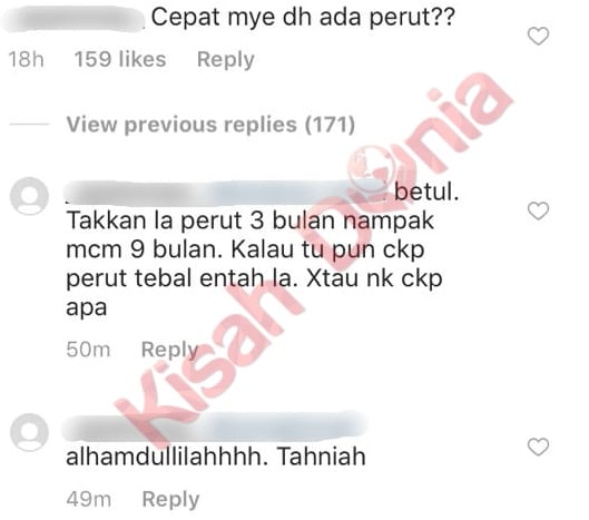 Kandungan Baru Beberapa Minggu, Perut ‘Buncit’ Fasha Sandha Jadi Bualan Netizen