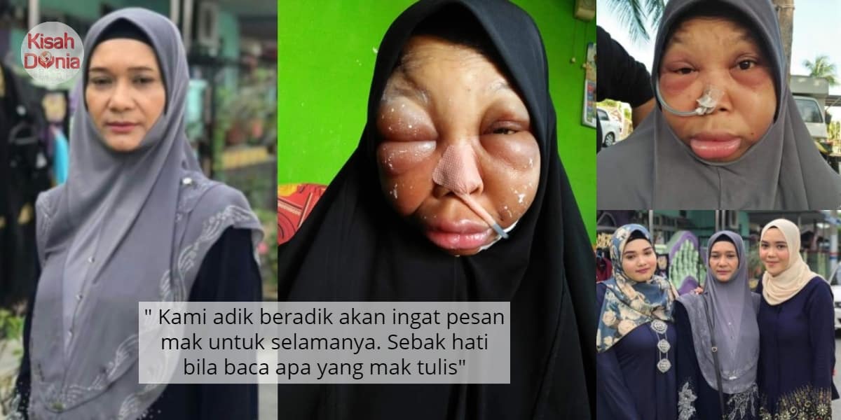 Kami Tak Pernah Halau.. Warga Asing Tolong Jangan Takut Untuk Dapatkan Rawatan