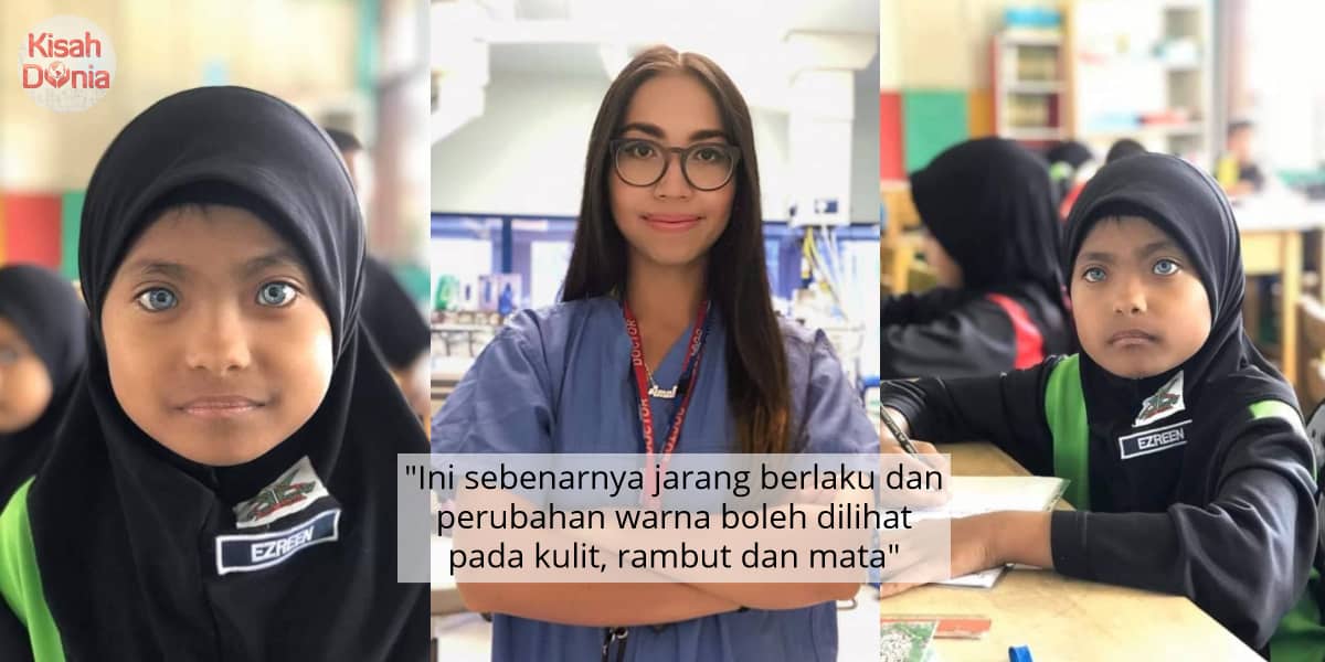 Foto Viral Budak Mata Biru Menarik Netizen, Dr Amalina Tampil Berikan Ulasan 8