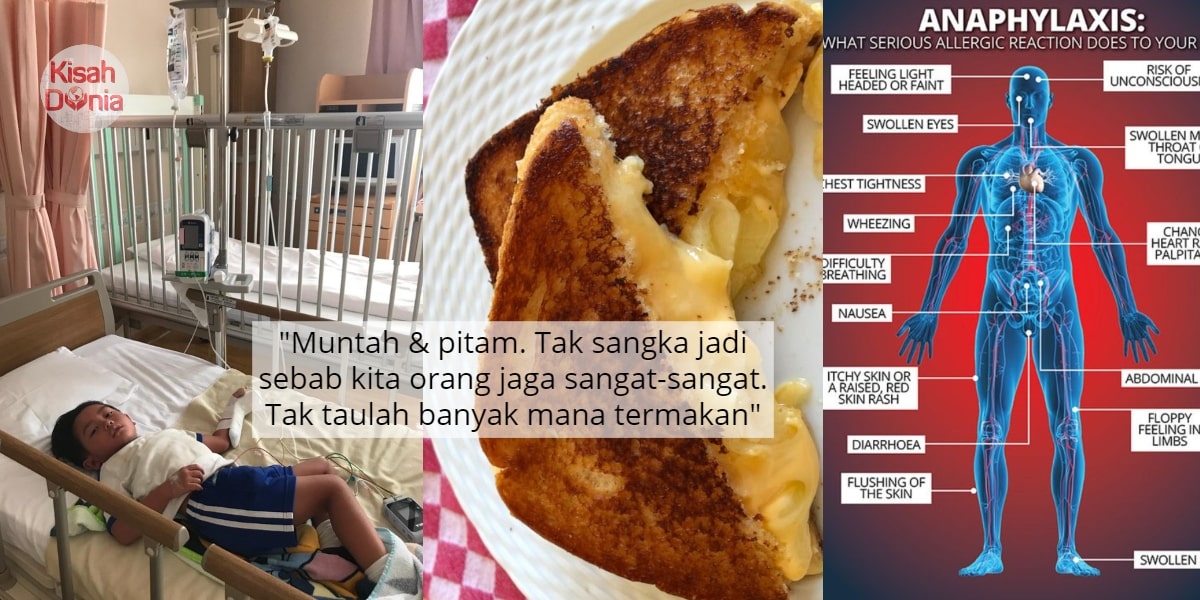 Masuk Emergency Room, Anak Tersilap Makan Cheese Hadapi 'Anaphylaxis Shock' 4