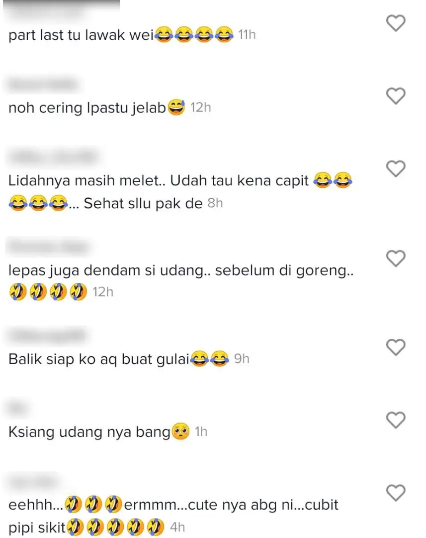 Baru Nak ‘Show Off’ Hasil Tangkapan, Lelaki Merana Pipi Disepit Udang Galah