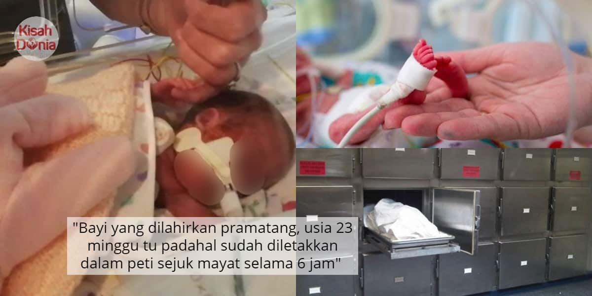 [VIDEO] Padah Sedut Penutup Botol, Gadis Pasrah ‘Experiment’ Bibir Tak Menjadi