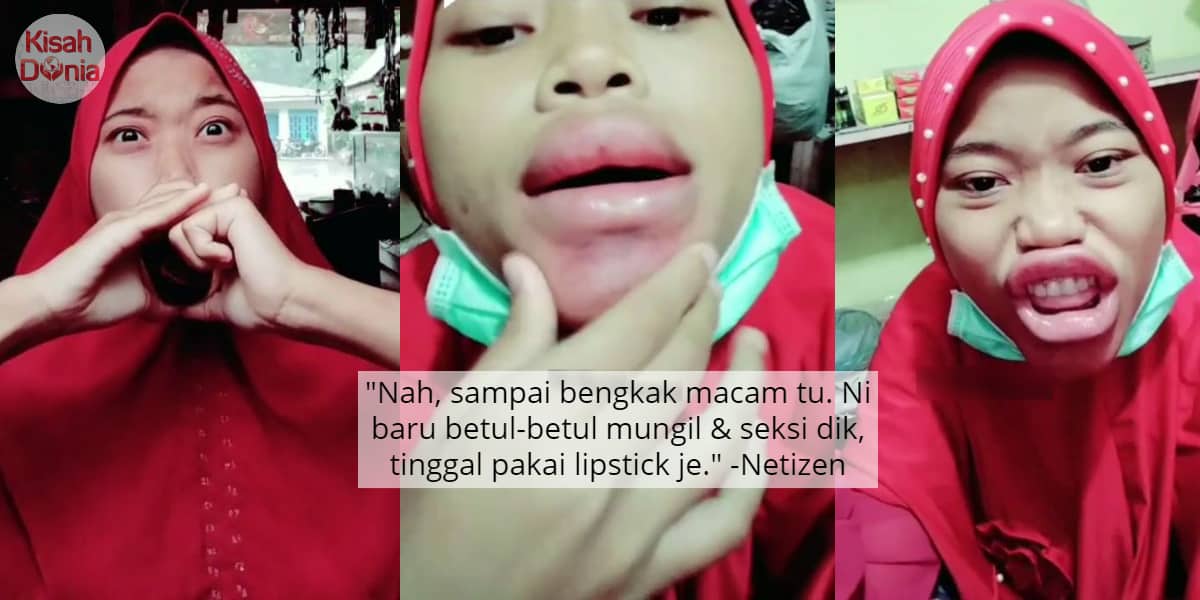 [VIDEO] Padah Sedut Penutup Botol, Gadis Pasrah 'Experiment' Bibir Tak Menjadi 38