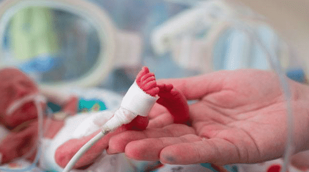 Ingatkan Tak Bernafas, Bayi Pramatang Hidup Semula Menangis Sebelum Dikebumi 4 Ingatkan Tak Bernafas, Bayi Pramatang Hidup Semula Menangis Sebelum Dikebumi 4