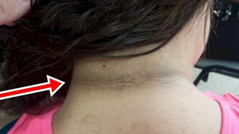 Geram Tengok Leher Anak Penuh Daki Hitam, Mak Letak Peluntur Dalam Air Mandian 3 Geram Tengok Leher Anak Penuh Daki Hitam, Mak Letak Peluntur Dalam Air Mandian 3