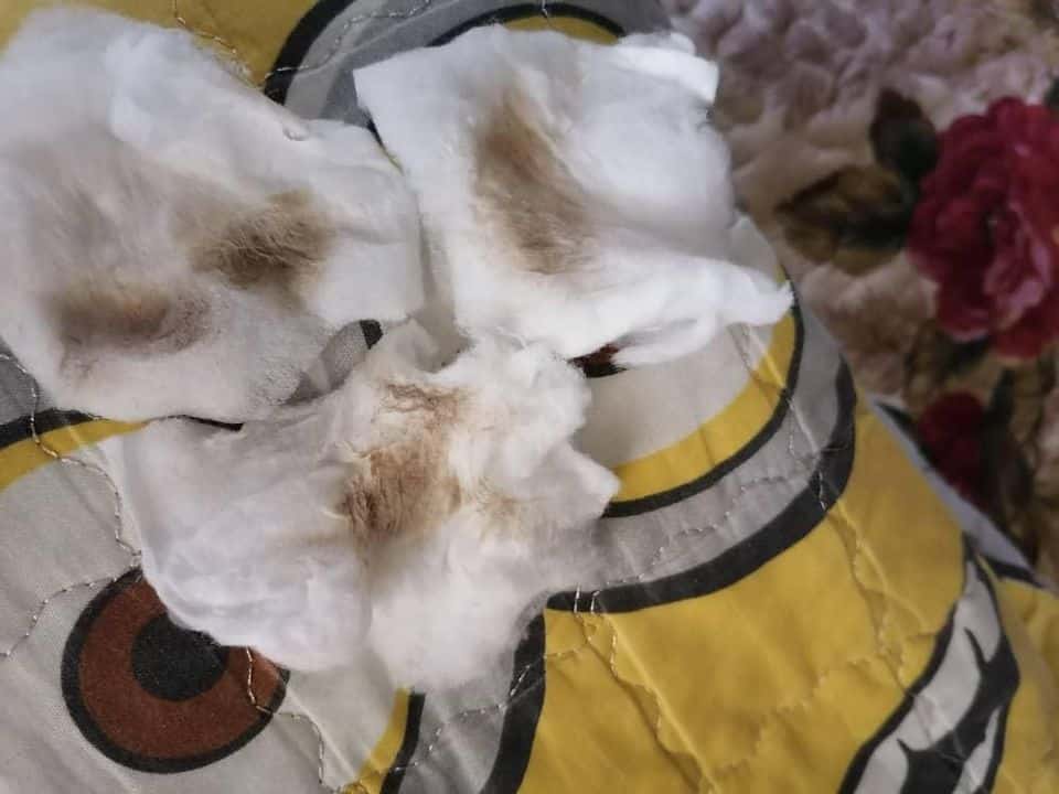 Geram Tengok Leher Anak Penuh Daki Hitam, Mak Letak Peluntur Dalam Air Mandian 4 Geram Tengok Leher Anak Penuh Daki Hitam, Mak Letak Peluntur Dalam Air Mandian 4