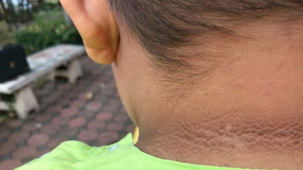 Geram Tengok Leher Anak Penuh Daki Hitam, Mak Letak Peluntur Dalam Air Mandian 5 Geram Tengok Leher Anak Penuh Daki Hitam, Mak Letak Peluntur Dalam Air Mandian 5