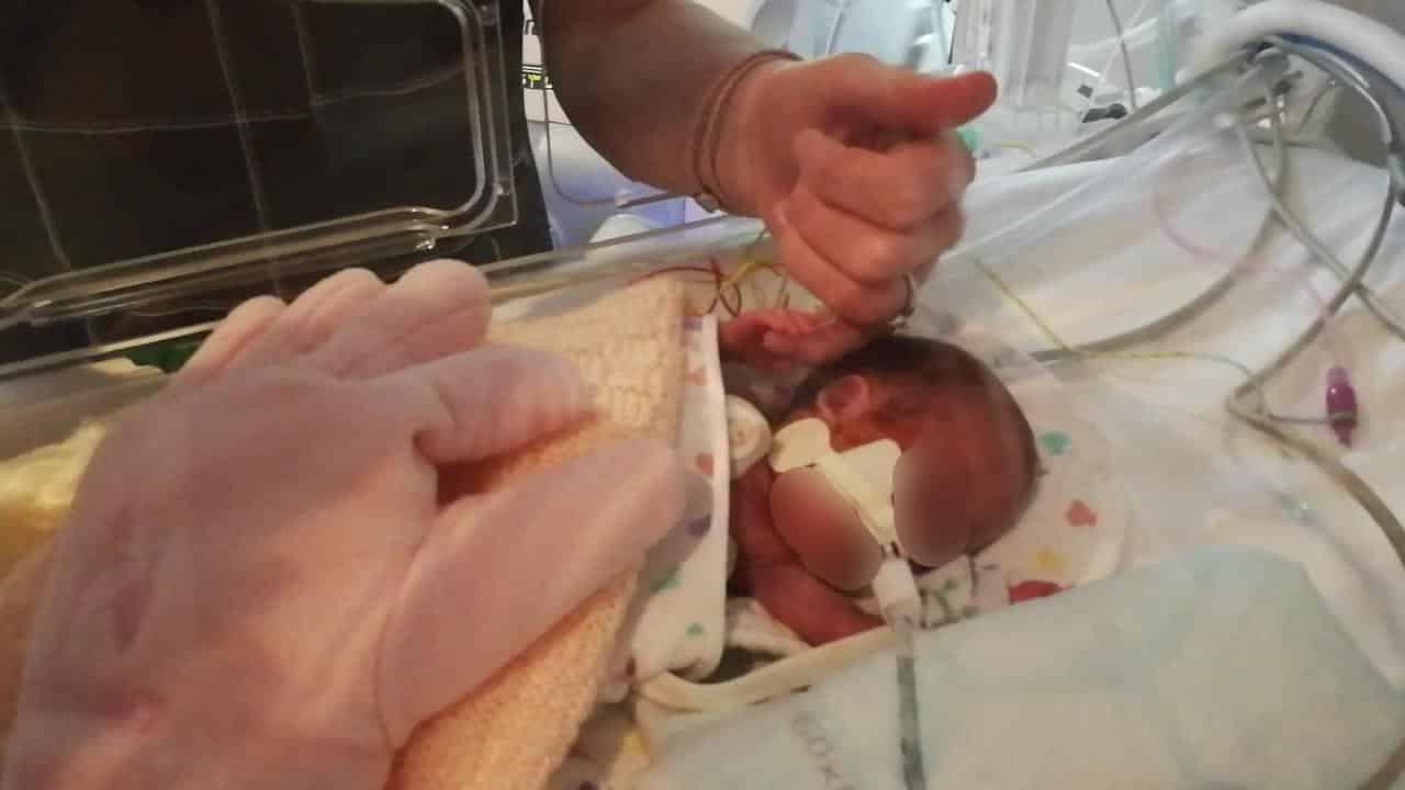 Ingatkan Tak Bernafas, Bayi Pramatang Hidup Semula Menangis Sebelum Dikebumi 3 Ingatkan Tak Bernafas, Bayi Pramatang Hidup Semula Menangis Sebelum Dikebumi 3