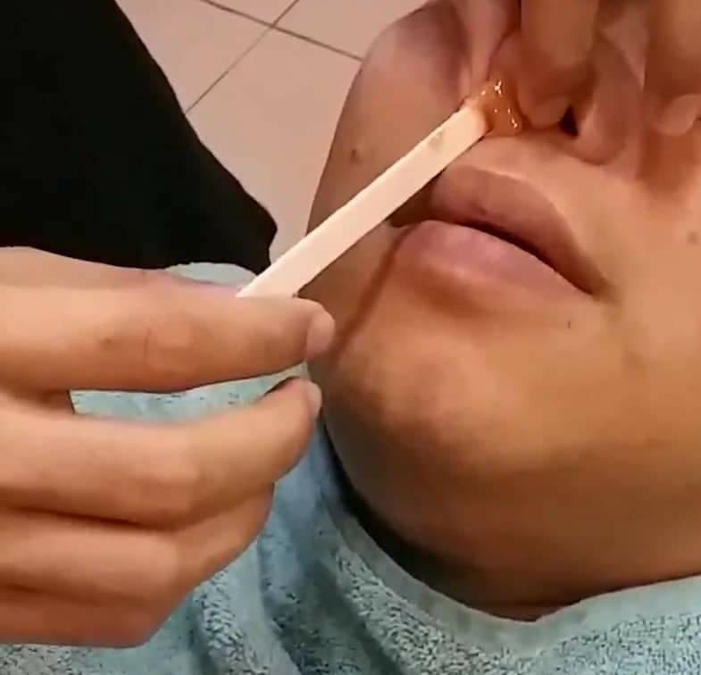 Konon Puas, Rupanya Tabiat Cabut Bulu Hidung & Picit Jerawat Undang Risiko 8 Konon Puas, Rupanya Tabiat Cabut Bulu Hidung & Picit Jerawat Undang Risiko 8